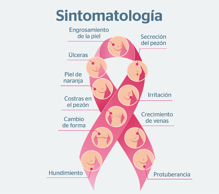 Infografía sobre los síntomas más frecuentes del cáncer de mama