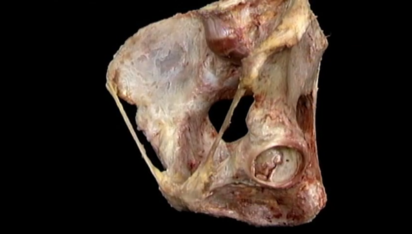 Vista de una disección de una cadera humana